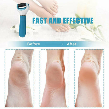 electronic dry foot file for hard skin with before and after results showcasing smooth feet