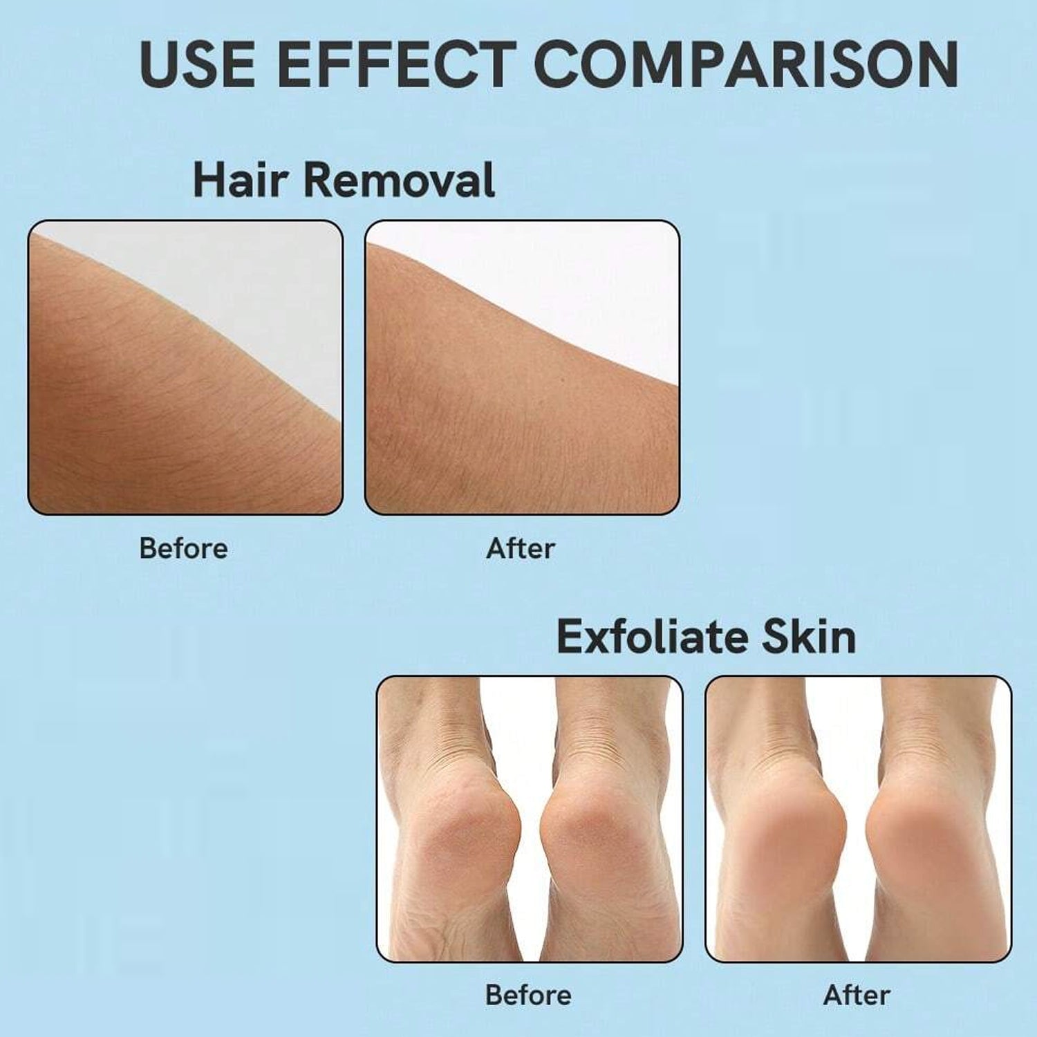 portable skin hair remover device before and after results showing smooth hair removal and exfoliated skin